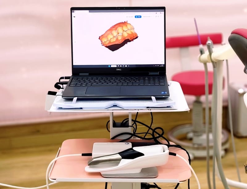 Escáner intraoral 3D