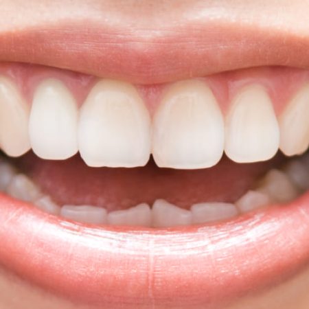 Contorneado Contorneado