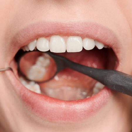 Empaste Empaste Dental