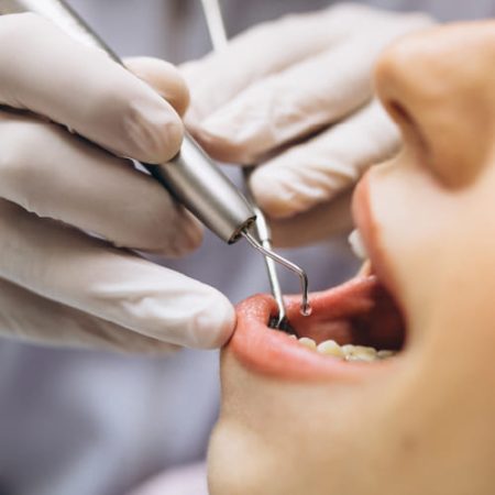 Endodoncia Endodoncia