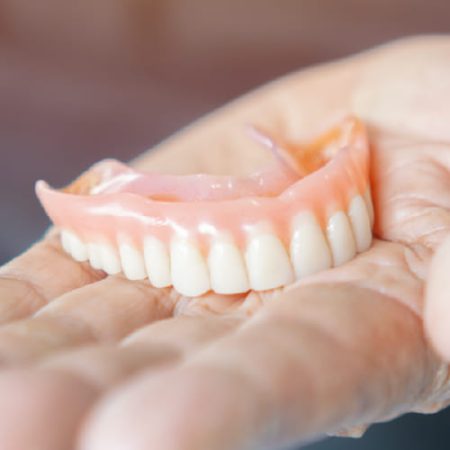 Protesis removible Protesis removible