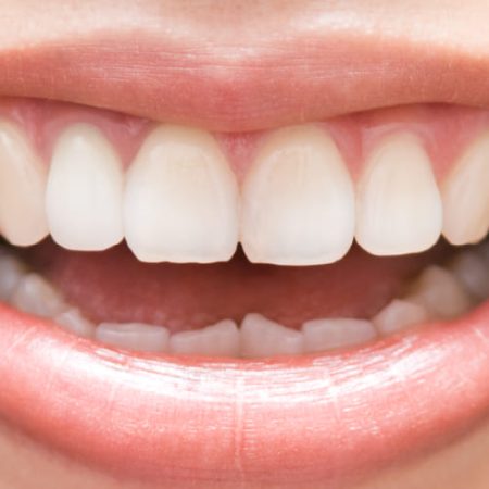 Reconstucción Reconstrucción dental