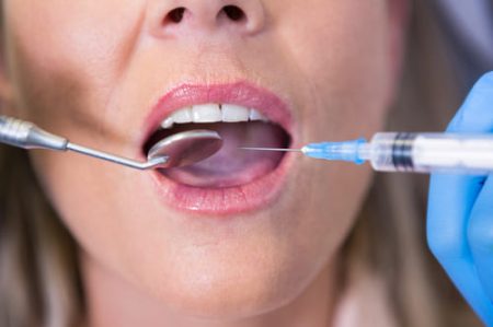 vista-de-angulo-alto-de-dentista-sosteniendo-la-jeringa-por-la-boca-del-paciente Cirugía de encías